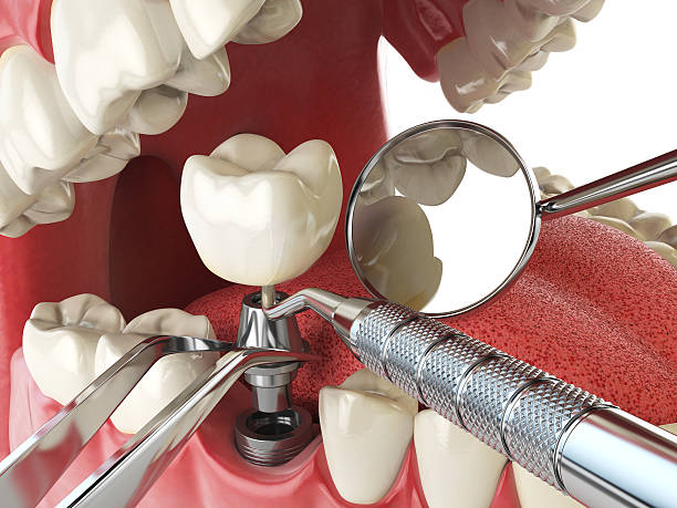 Best Emergency Dental Extractions in Goshen, AR