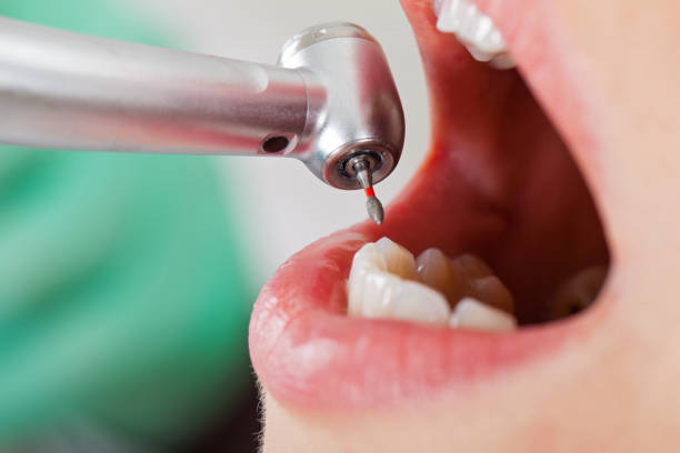Best Broken or Cracked Tooth Emergency Dentist in Goshen, AR